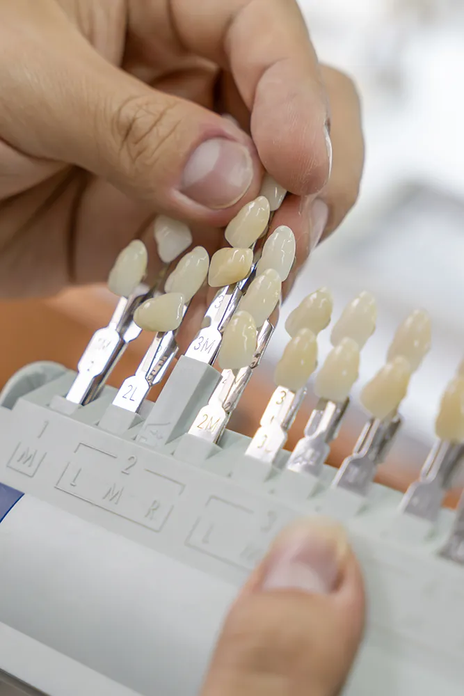 Dental Veneers at Rex Medical Centre