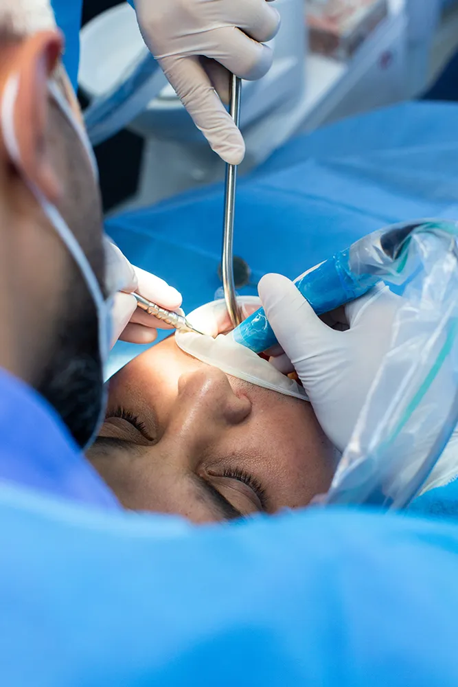 Root Canal Consultation