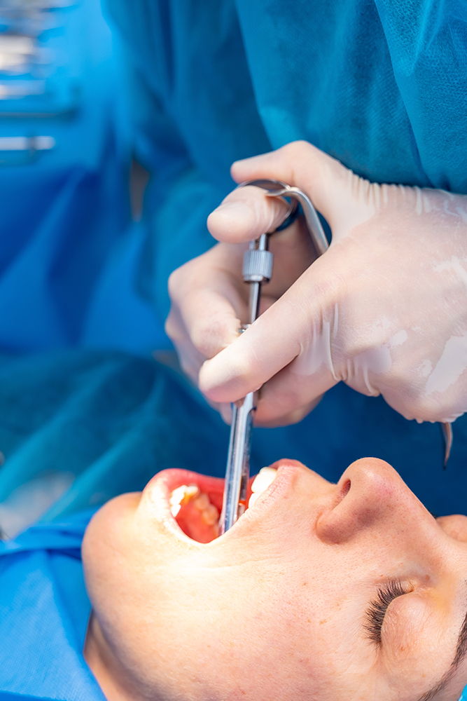 Oral Surgery at Rex Medical Centre