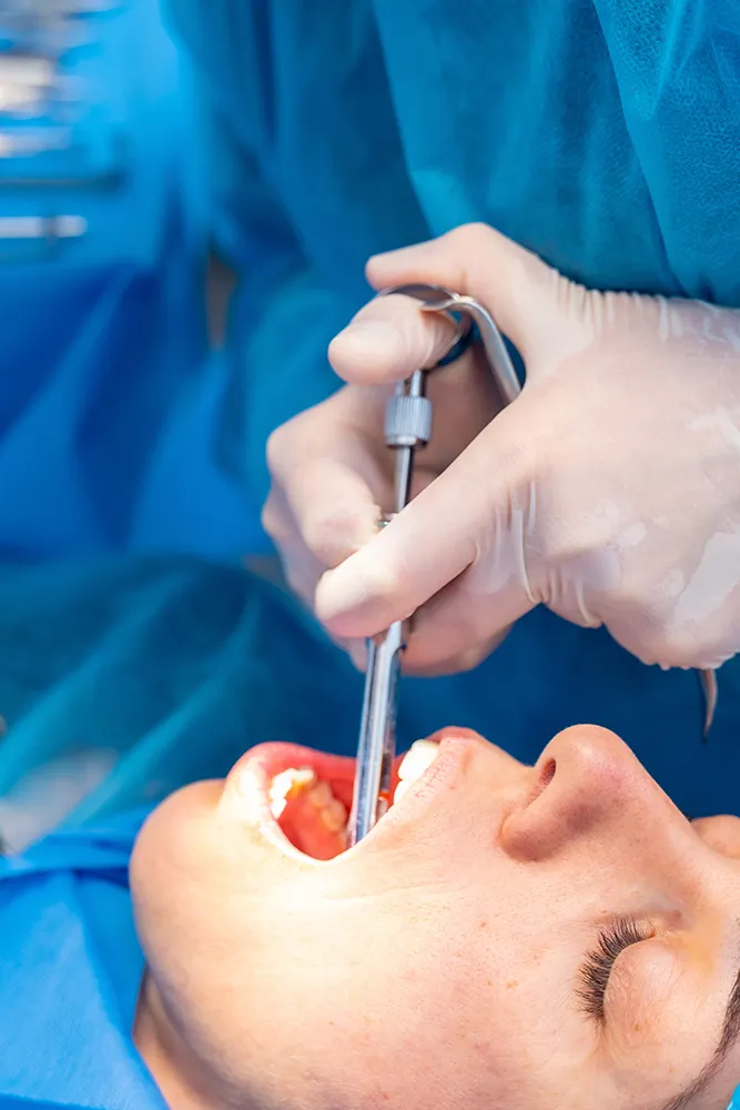Oral Surgery at Rex Medical Centre