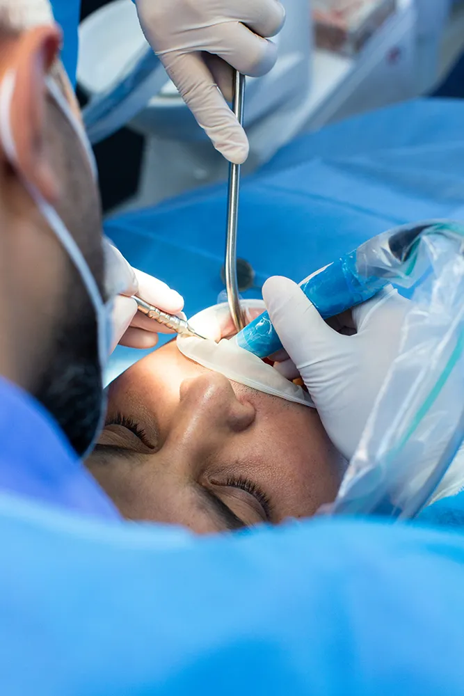 Root Canal Consultation