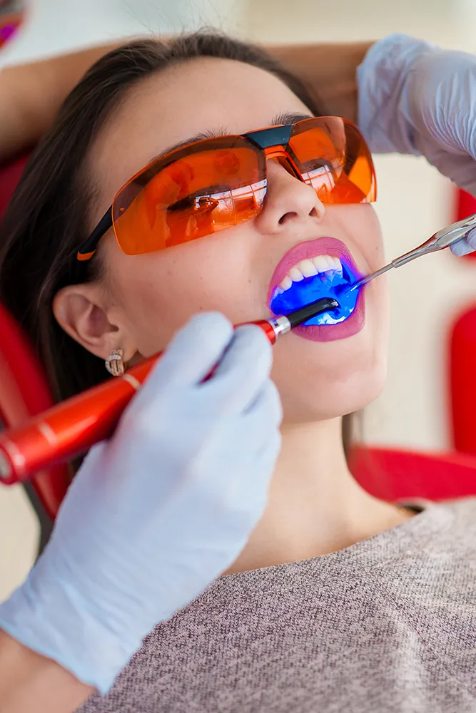 Teeth Whitening at Rex Medical Centre