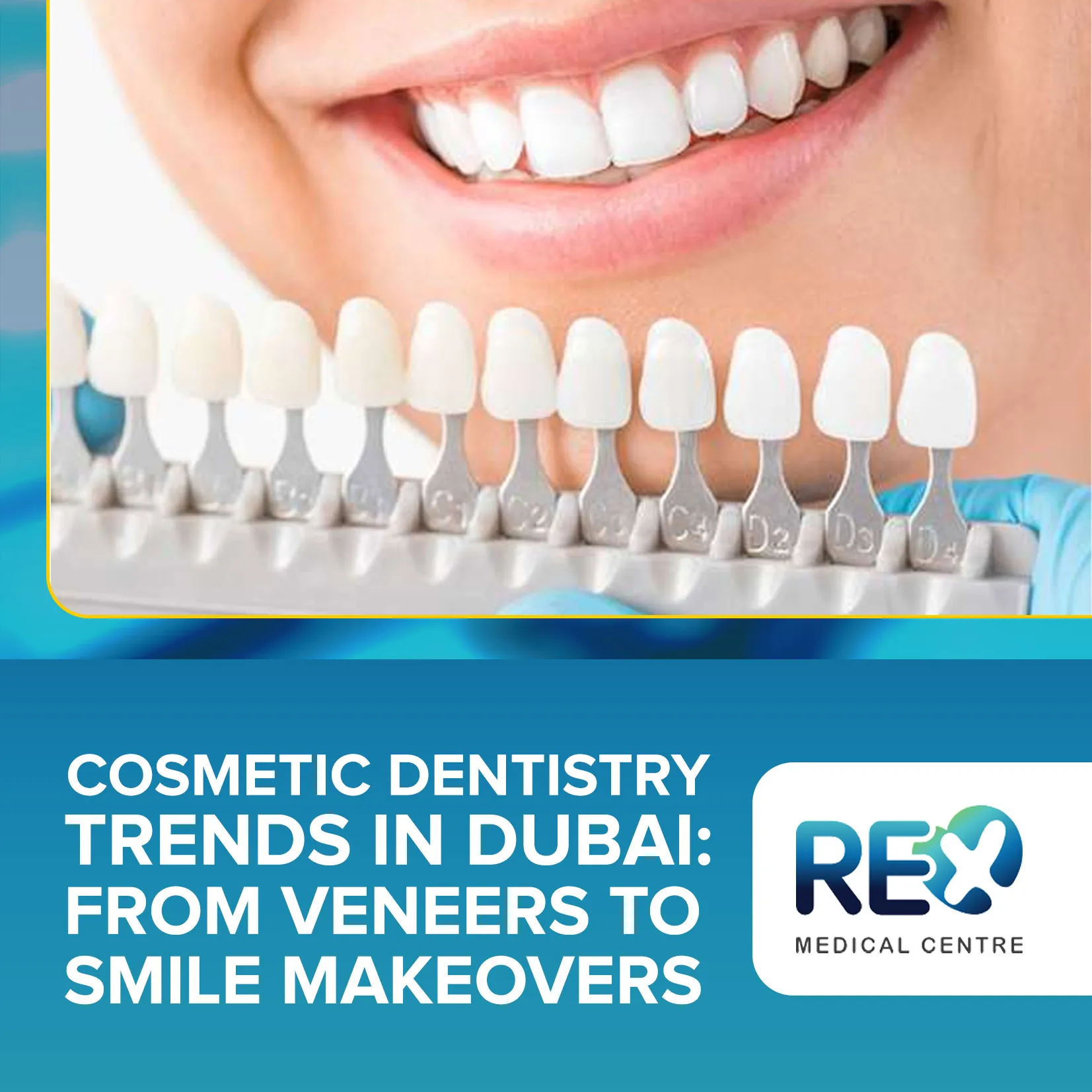 Cosmetic Dentistry Trends in Dubai: From Veneers to Smile Makeovers