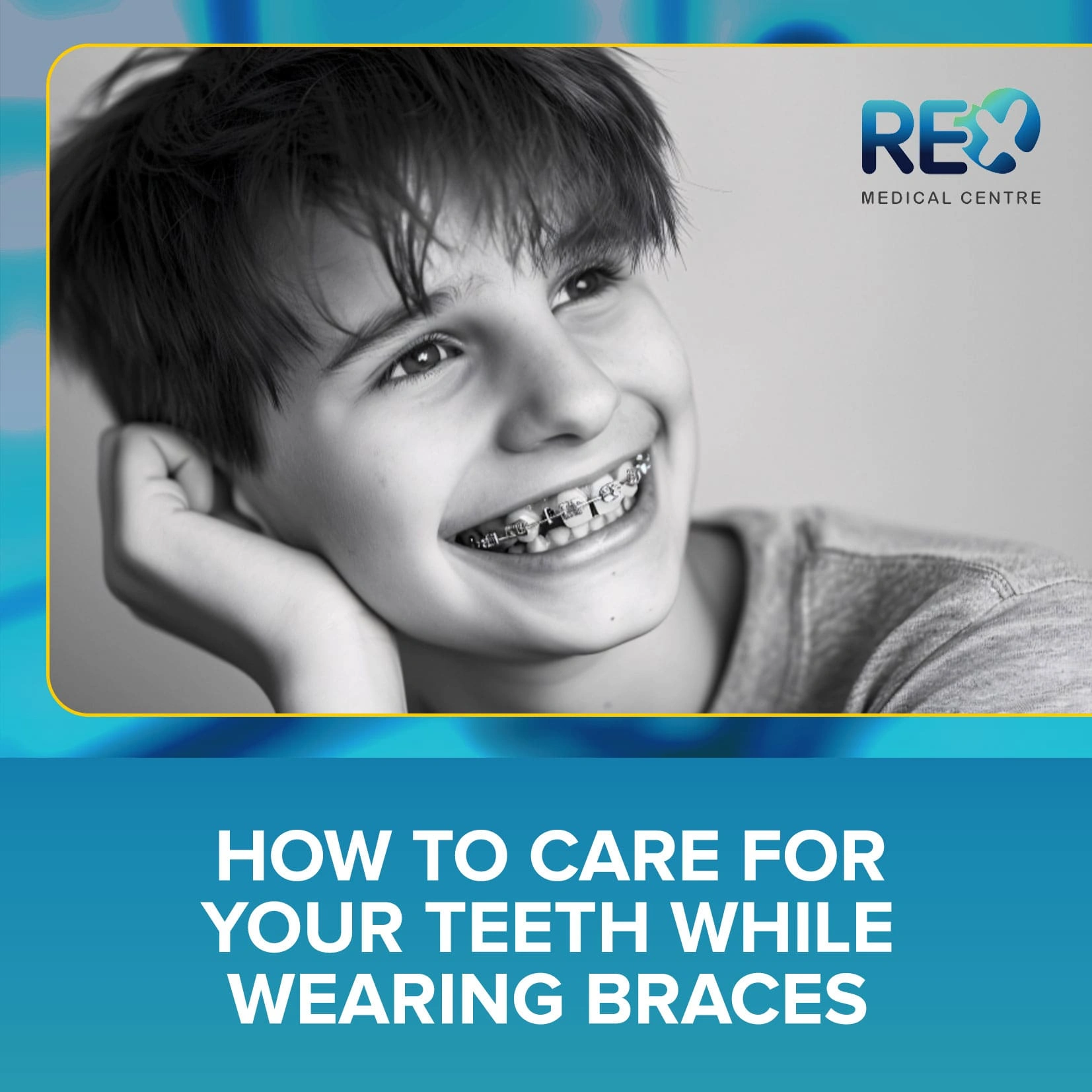 How to Care for Your Teeth While Wearing Braces
